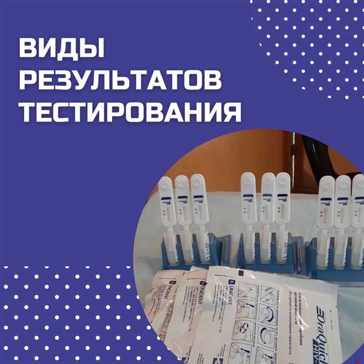 Что проверяют в СПИД центре: полный список анализов и исследований