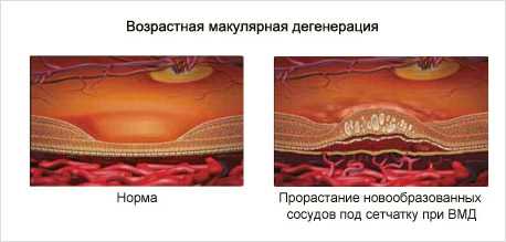 Дегенерация и деградация: в чем разница?