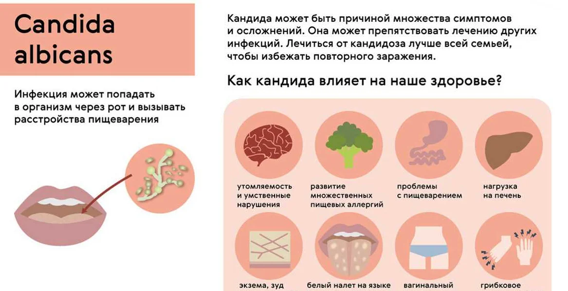 Гарднерелла и молочница: в чем разница и как это влияет на здоровье женщин?